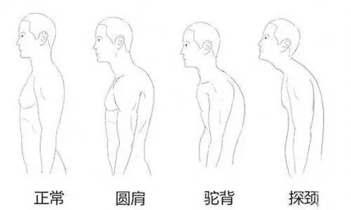 幾個動作，解決圓肩駝背問題，改善體態問題