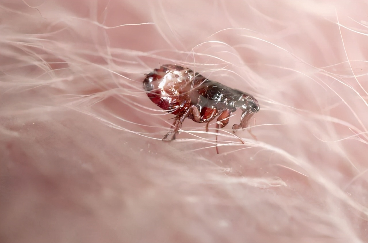 跳蚤咬了怎么止痒最快孕妇和小孩怎么止痒