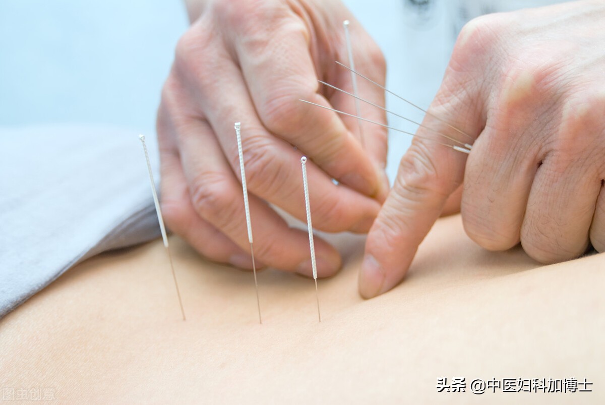 针灸哪种方法效果最好(针灸什么时间效果好) - 情书号