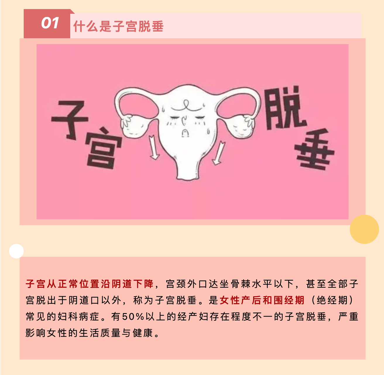 产后小腹总有下坠感，要警惕子宫脱垂啦