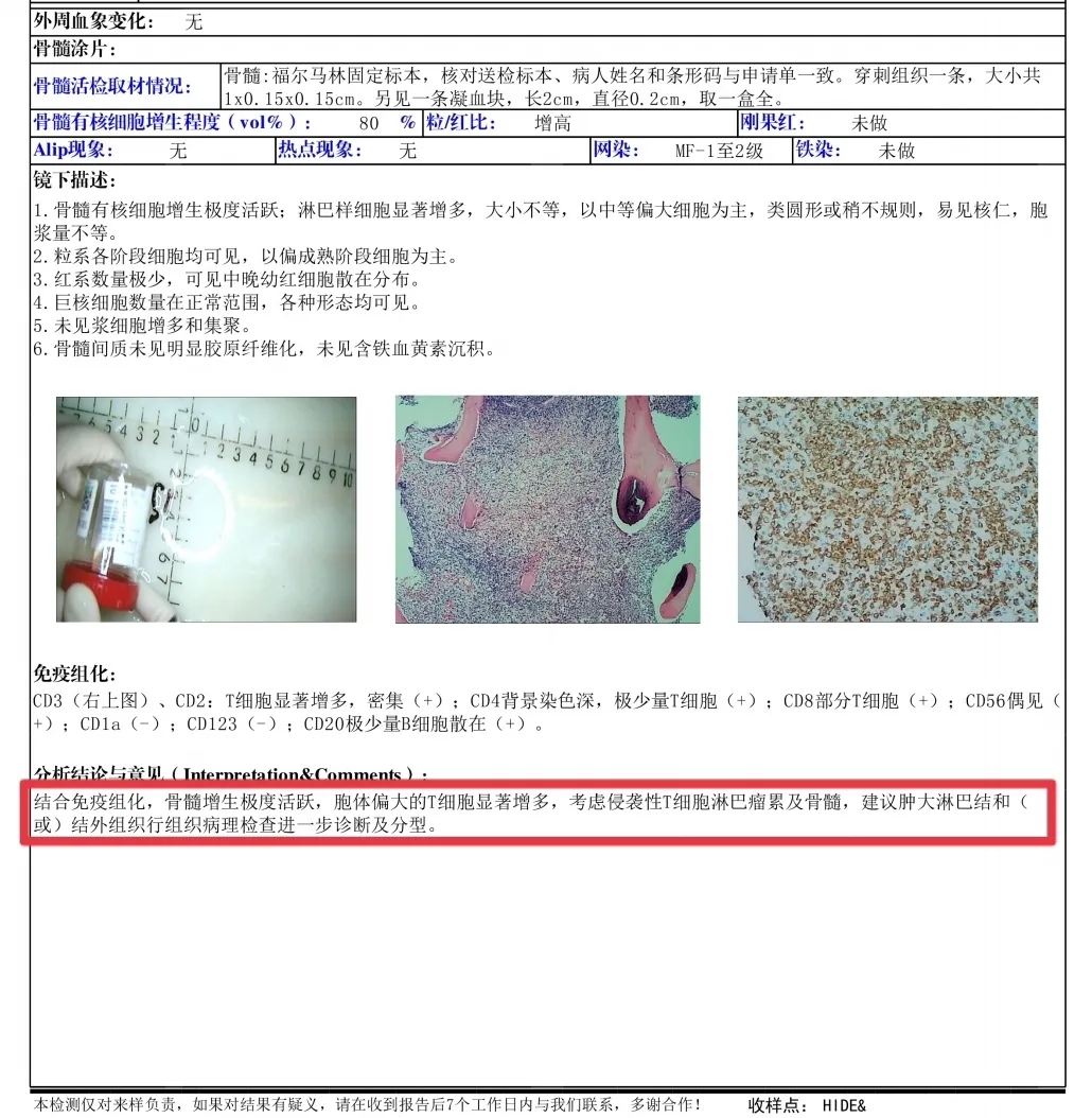 血液病诊疗过程中MICM-P再次检测非常重要