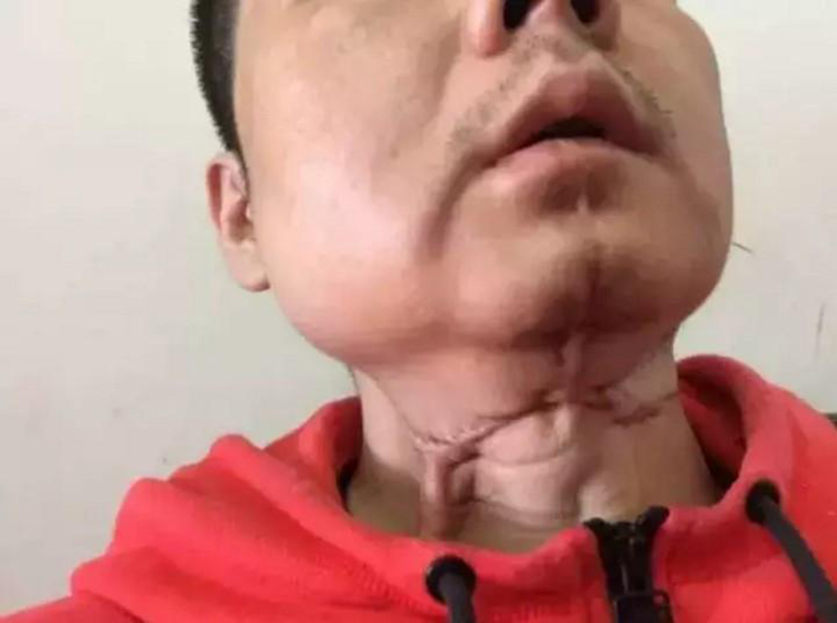 槟榔之殇:成瘾只是表象,6000万人的爱好,如何成割脸的诱因