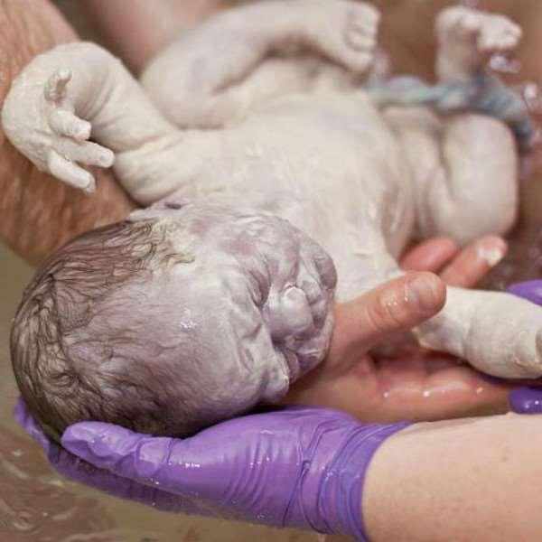 婴儿胎毒(新生儿出生时身上一层白的是什么) - 乐宝宝贝