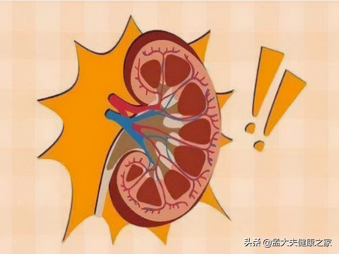 尿酸高，如何让尿酸排出体外？总结3个办法，实用有效