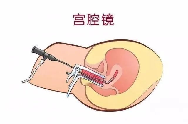 子宫内膜增厚怎么回事？子宫内膜增厚的危害有哪些？