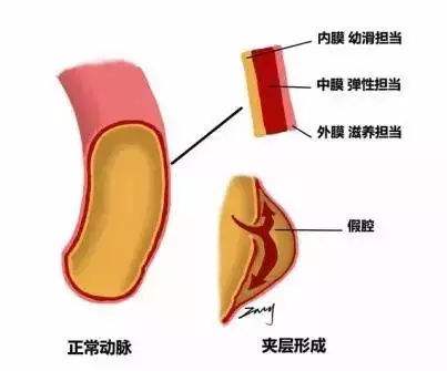 脖子上有个“死穴”，一个吻导致的死亡过程都经历了什么？