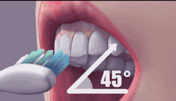 关于「洗牙」网友问得最多最奇葩的20个问题！涨知识