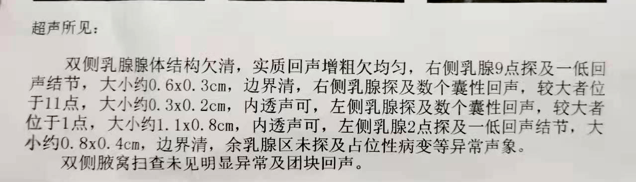 乳腺彩超报告，没有这几点就不必过于忧心