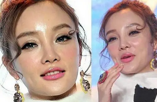 娱乐圈10位被整容毁掉的女星，有人脸僵如石，有的命丧手术台