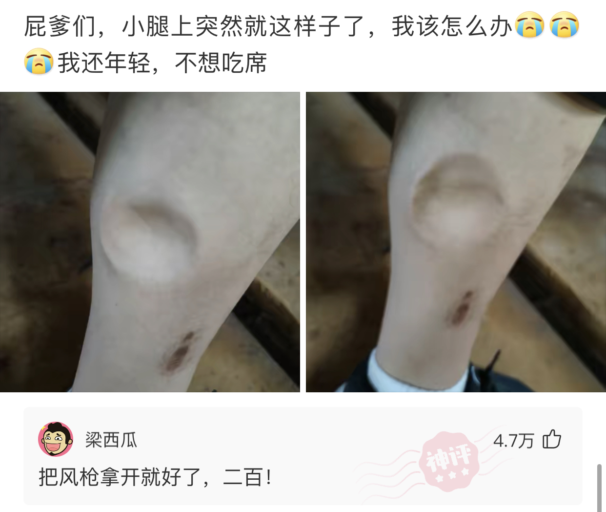 神回复：姨妈住院了，我拎了可乐和雪碧，大瓶那种，难道很寒碜吗