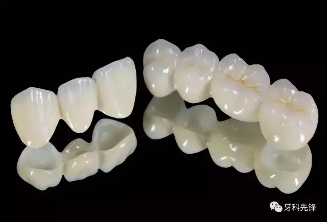 烤瓷牙、全瓷牙哪个更好?优缺点对比分析