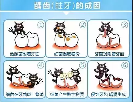几十块钱就能补好的牙,久拖不治,以至要花上万,冤不冤?