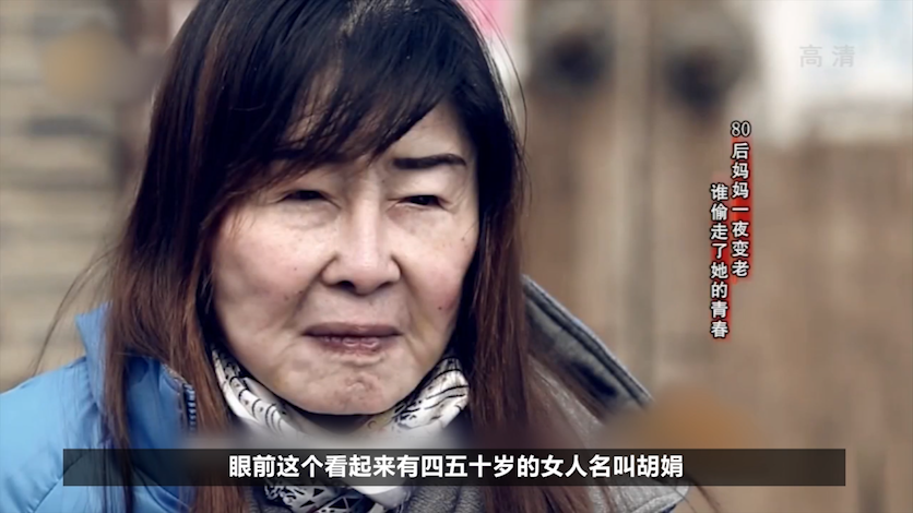 20歲女子一夜之間容貌衰老到80歲，被兒子疏遠後一心求死，紀錄片
