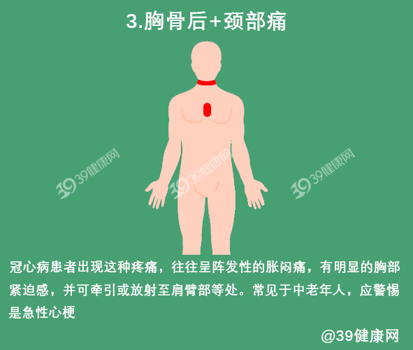 心肌缺血会出现哪些典型和不典型症状？怎么检查和吃药？一文说清