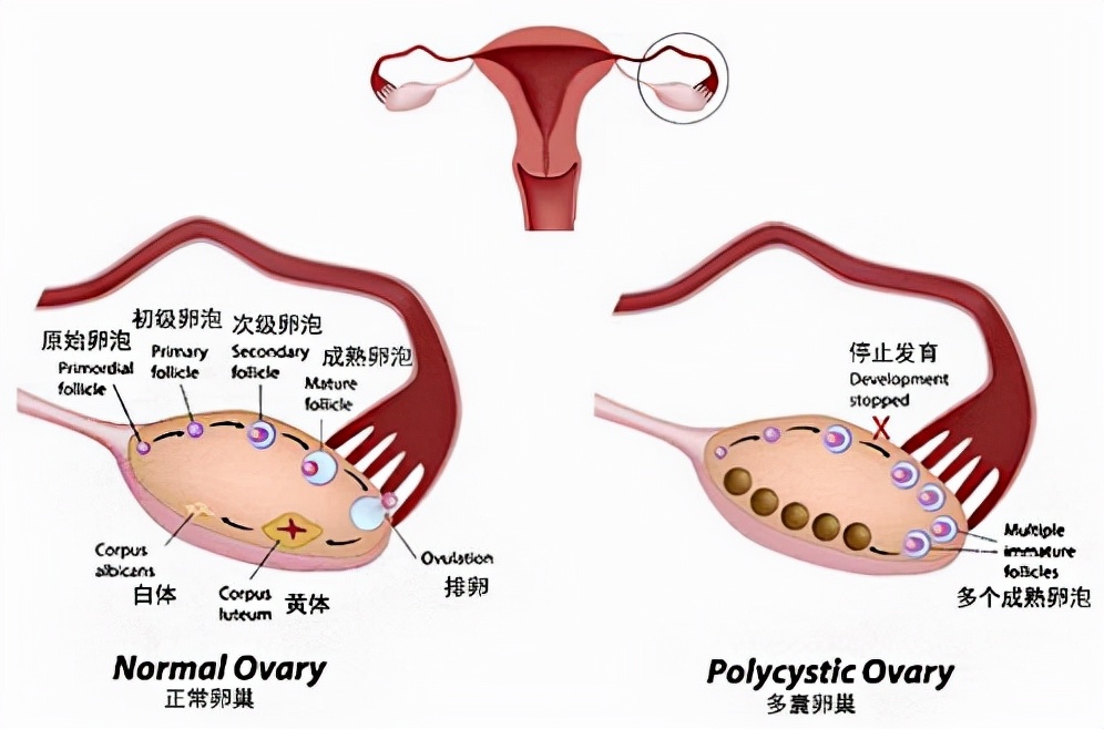 英国女子自己操作人工授精,一次成功!普通人千万不要尝试