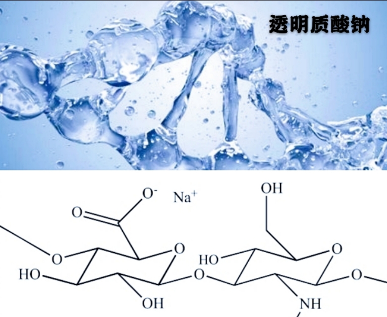 如果您膝盖疼，医生建议注射玻璃酸钠，但您有诸多疑惑！请看此文