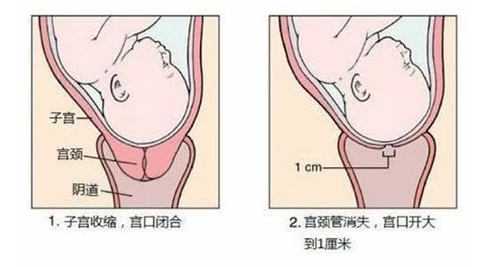 分娩时狭窄的产道如何生娃？这个演示太真实，看完感叹母亲伟大