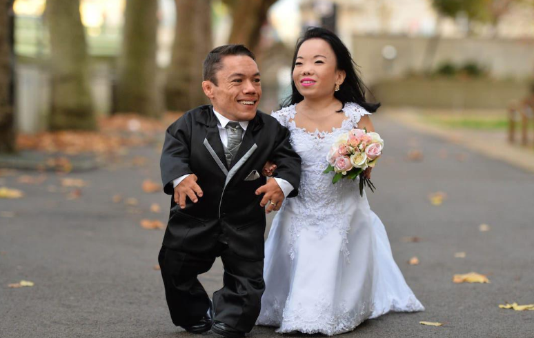 显然和正常人看起来是不一样的,医学角度认定这位小女孩患有侏儒症