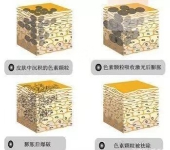 想要皮肤白，“娃娃”留下来，细说黑脸娃娃和白瓷娃娃