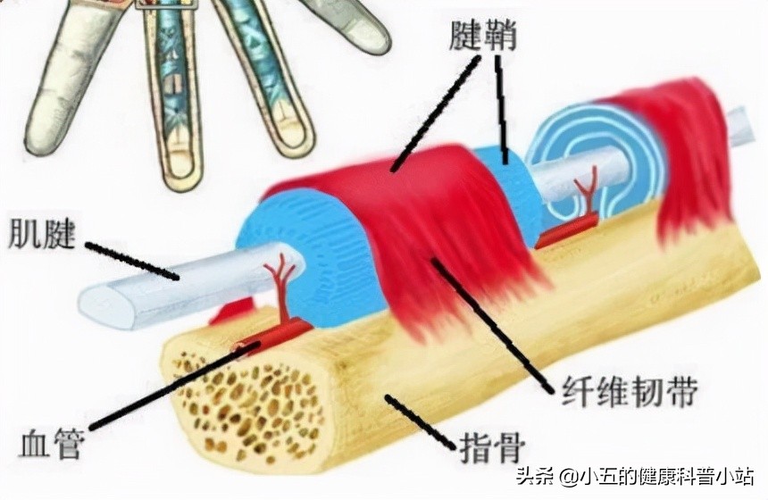 手指头突然不能动了？屈伸关节有弹响？烦人的腱鞘炎到底怎么治