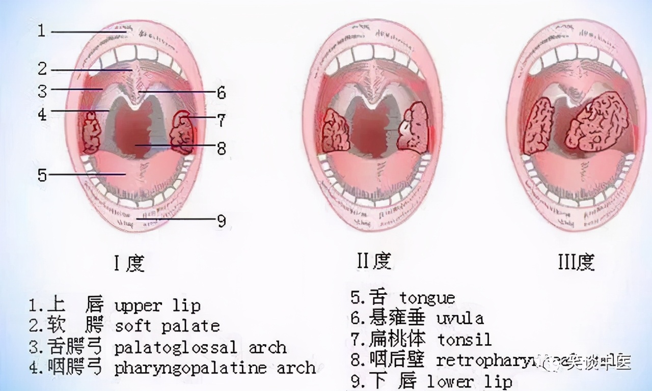 孩子扁桃体发炎，手术还是保守治疗？中医分析：扁桃体手术的利弊