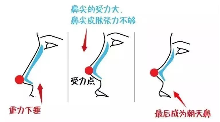 古力娜扎的鼻孔外露太抢镜，教你3招改善这个问题