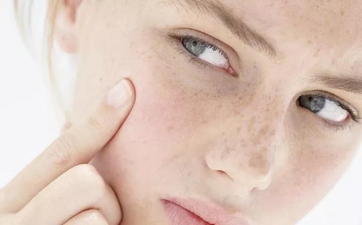 缺水的皮肤会出现什么样的症状呢 皮肤缺水怎么办？