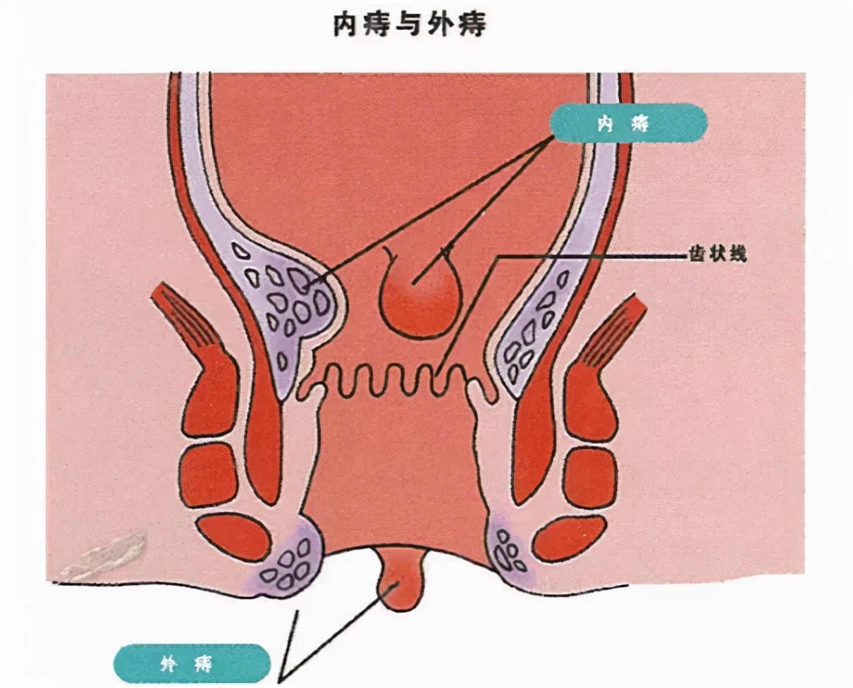 孩子严重便秘危害大，家长需重视并及时采取科学调理措施帮助缓解