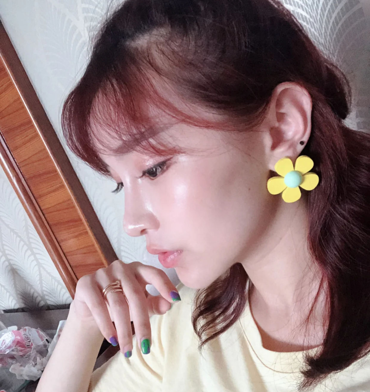 大部分女生为了风险小还是会选择先打玻尿酸看看效果