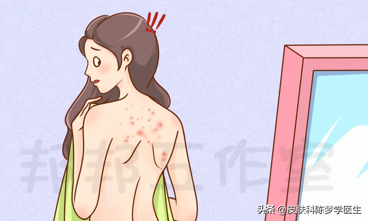 毛囊炎反复发作原因揭秘：为何痘痘久治不愈？专家解析诱因与应对方法