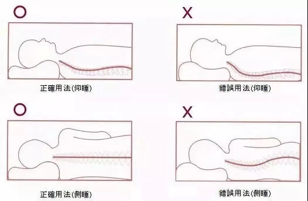 脖子後面骨頭凸起圖片(脖子後面鼓個) - 赤虎壹號