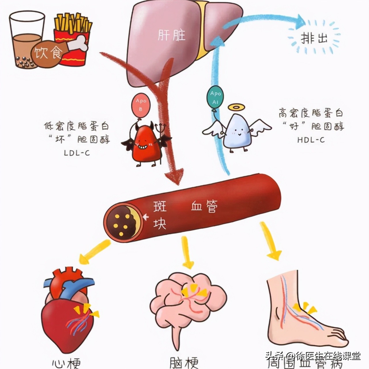 医生一步一步教您看血脂化验单，并不是有箭头就不正常