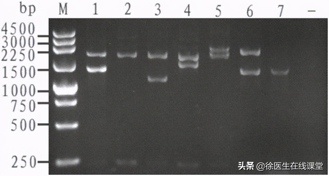 地中海贫血是什么 地中海贫血症状有哪些