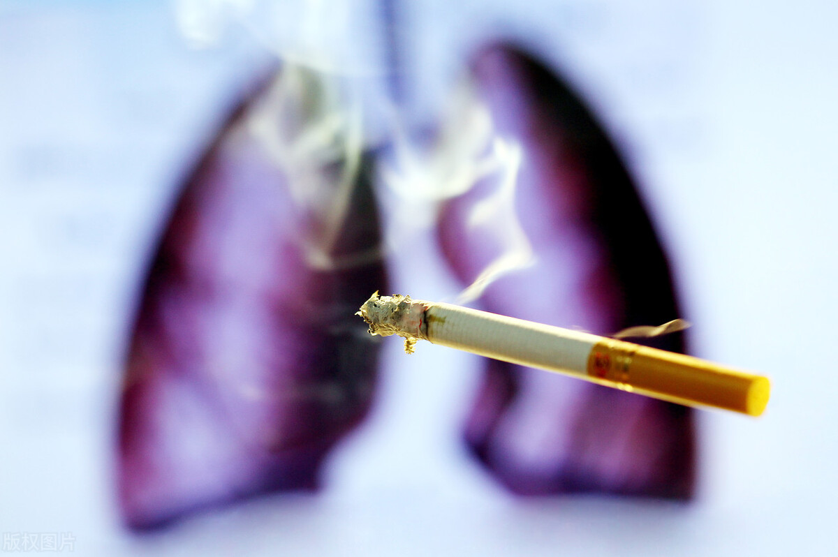 得了肺癌什么时候才开始痛？肺癌早期4大症状