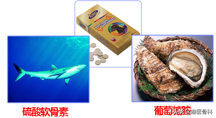 氨基葡萄糖是不是药品？需要凭处方买吗？别再被骗了