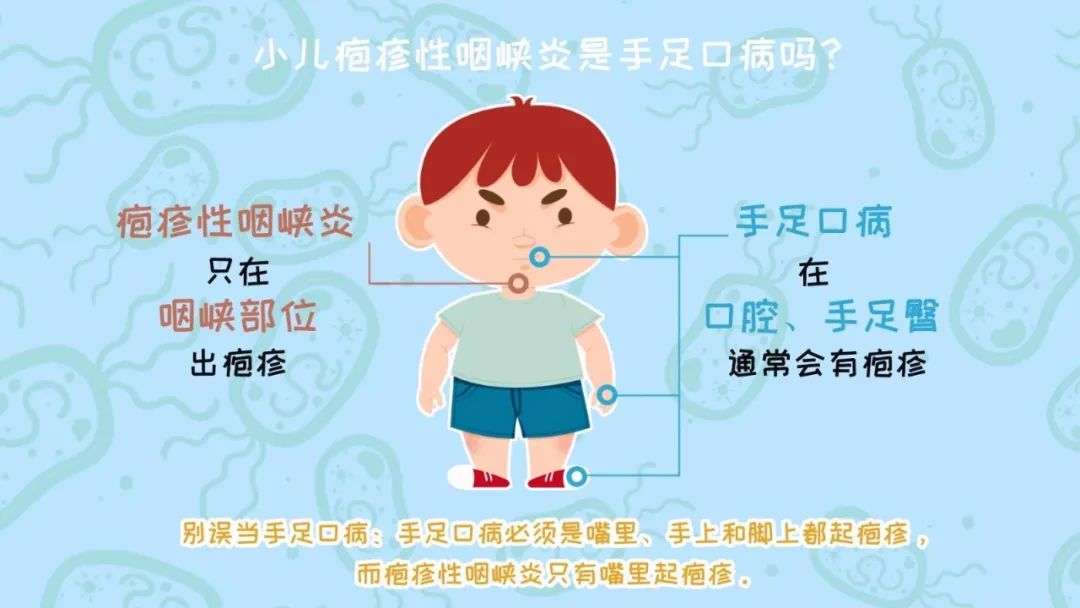 小儿疱疹性咽颊炎的调理思路 推拿手法