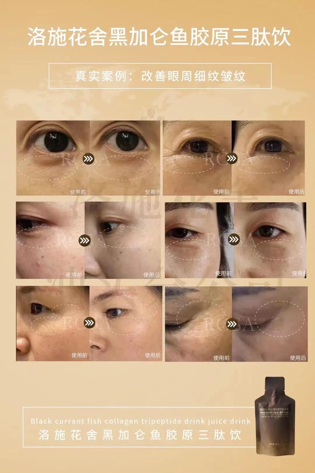 洛施花舍黑加仑抗衰饮效果怎么样？多少钱？