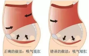 直肠脱垂，可以自行恢复吗，还是想要一托了之，恐怕没那么简单