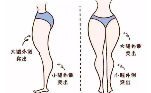 多按摩就能纠正肌肉腿？辟谣：吴昕粗腿变长腿，全靠2个负重法