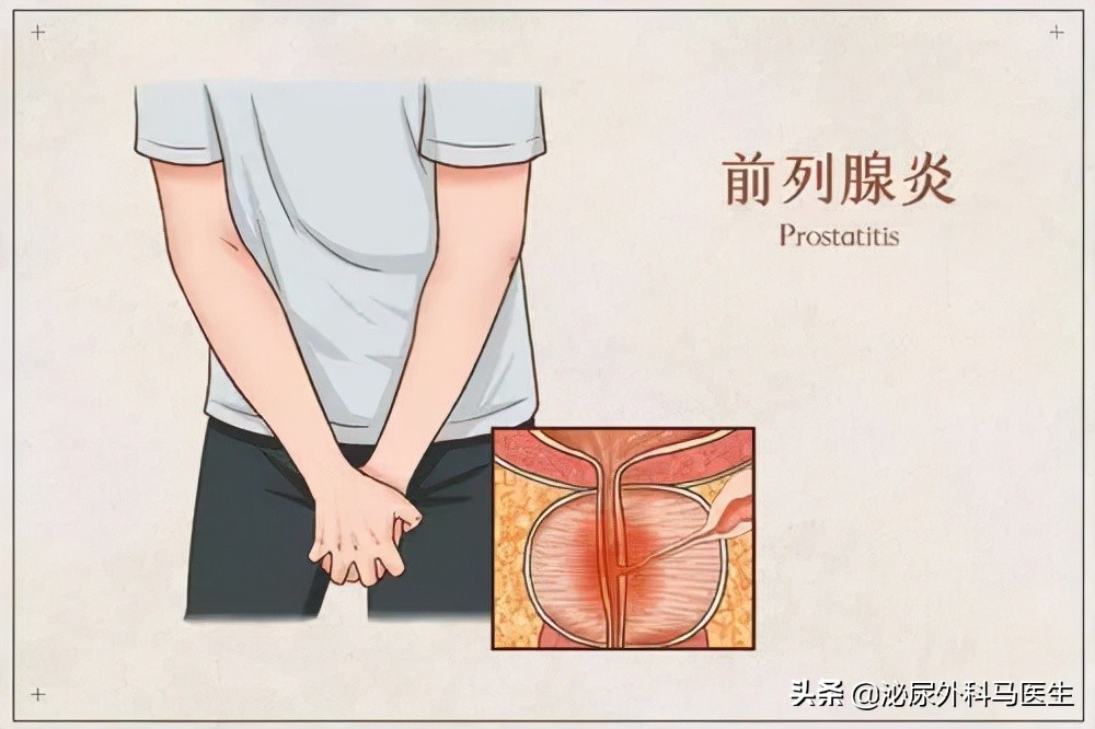 尿道肉阜图片的症状(男性尿道口总有分泌物是怎么回事) - 赤虎壹号