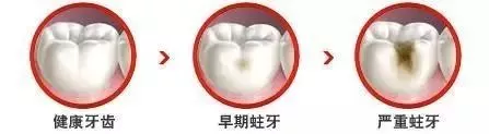 疼疼疼，牙疼怎么办？不是所有牙都有机会被补好！#雅悦齿科#