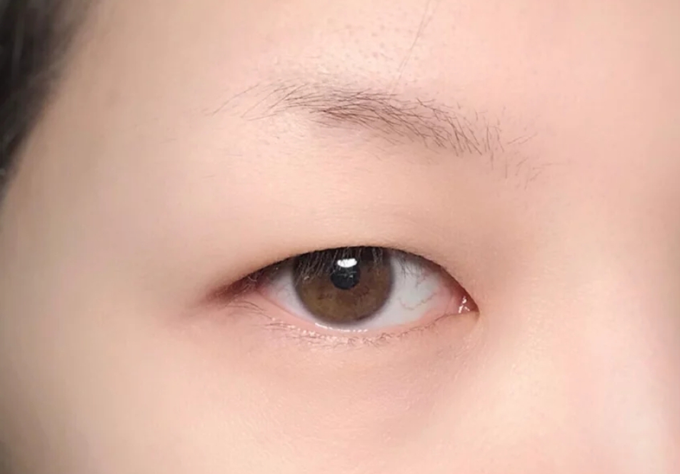 女生看看自己的眼尾,就能判断颜值是否达标,最后一种很少人有