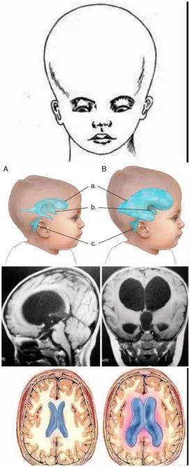 左撇子智商高?高智商的人大腦結構都不一樣?