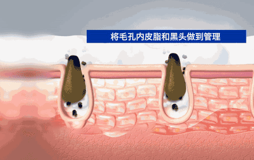 從明朝火到現在的國貨經典，洗洗臉就能祛痘