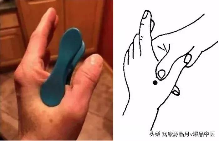 一个小夹子,一分钟缓解头痛?震惊外国网友的方法,中医这么说