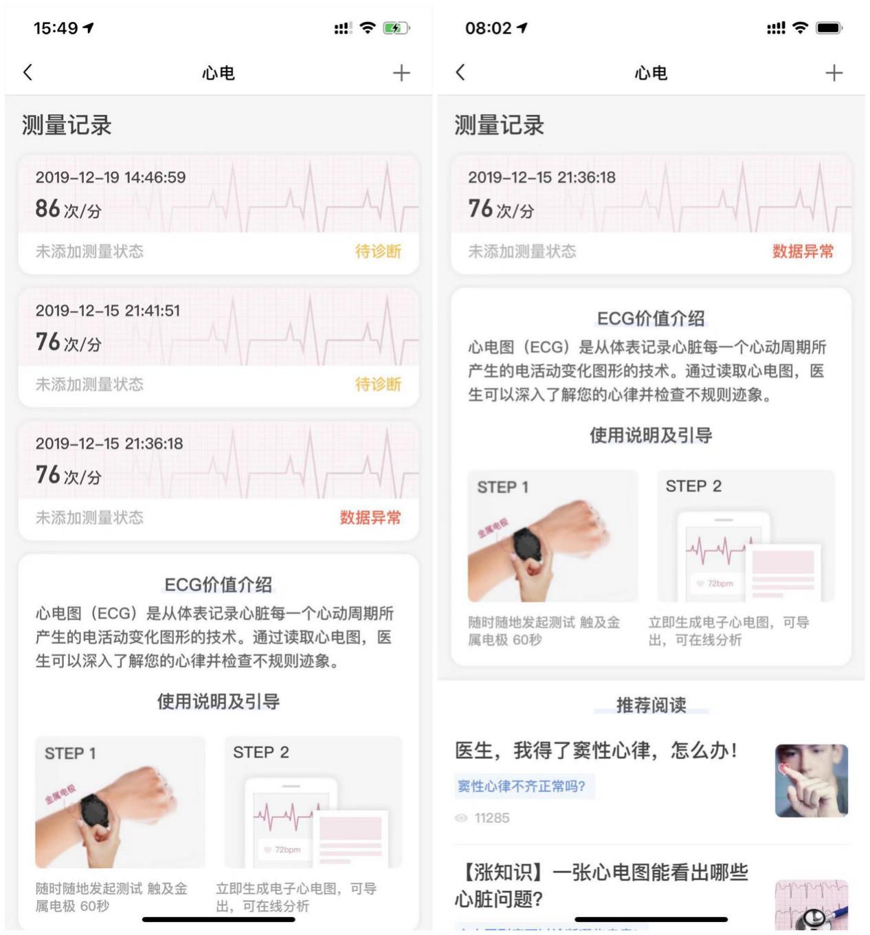 医学认可的测心率手表（性价比最高的医疗级健康手表）