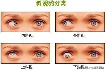#健康中国行动2030# 新生儿眼底筛查到底多重要!?各位宝妈宝爸抓紧了解~