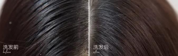 去屑洗发水深度测评，和头屑抗争多年，终于找到这4款，深度评测