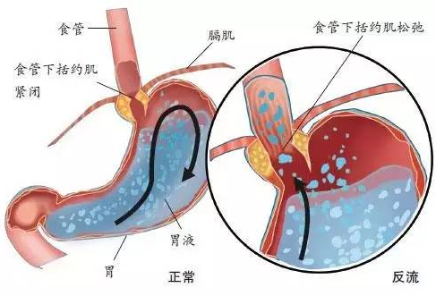 小狗精神差没胃口吃东西，注意“胃食管反流症病”来袭