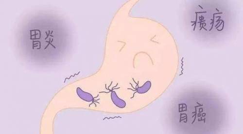 幽门螺杆菌“阳性”，是不是很严重，要不要治疗？医生告诉你